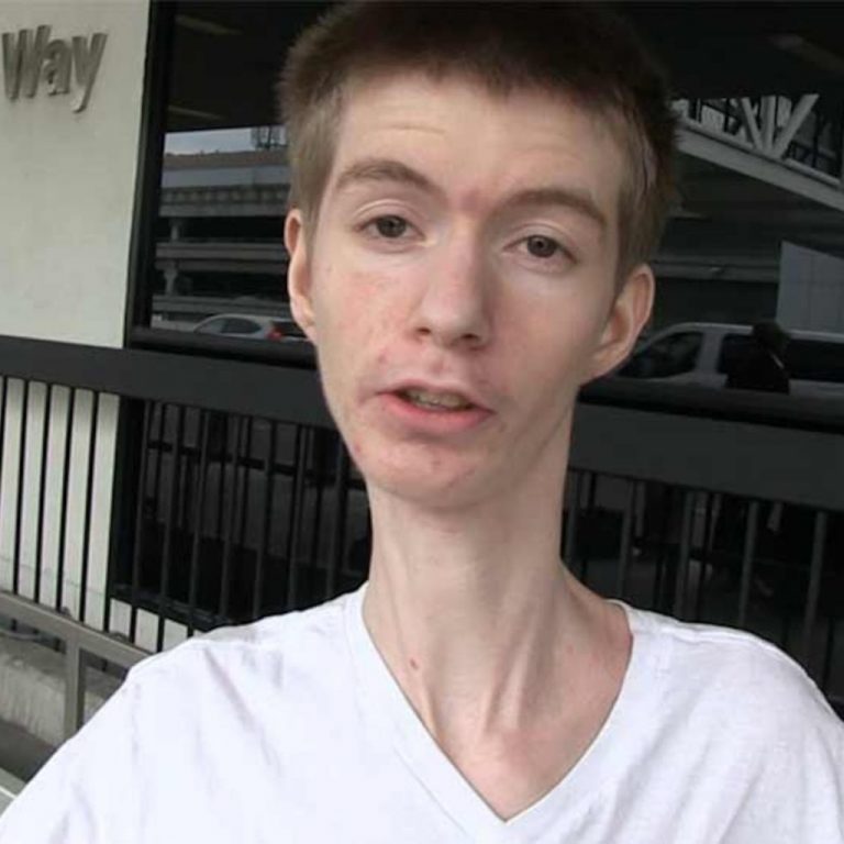 What’s wrong with Daddy Long Neck? Wiki, illness, age, net worth